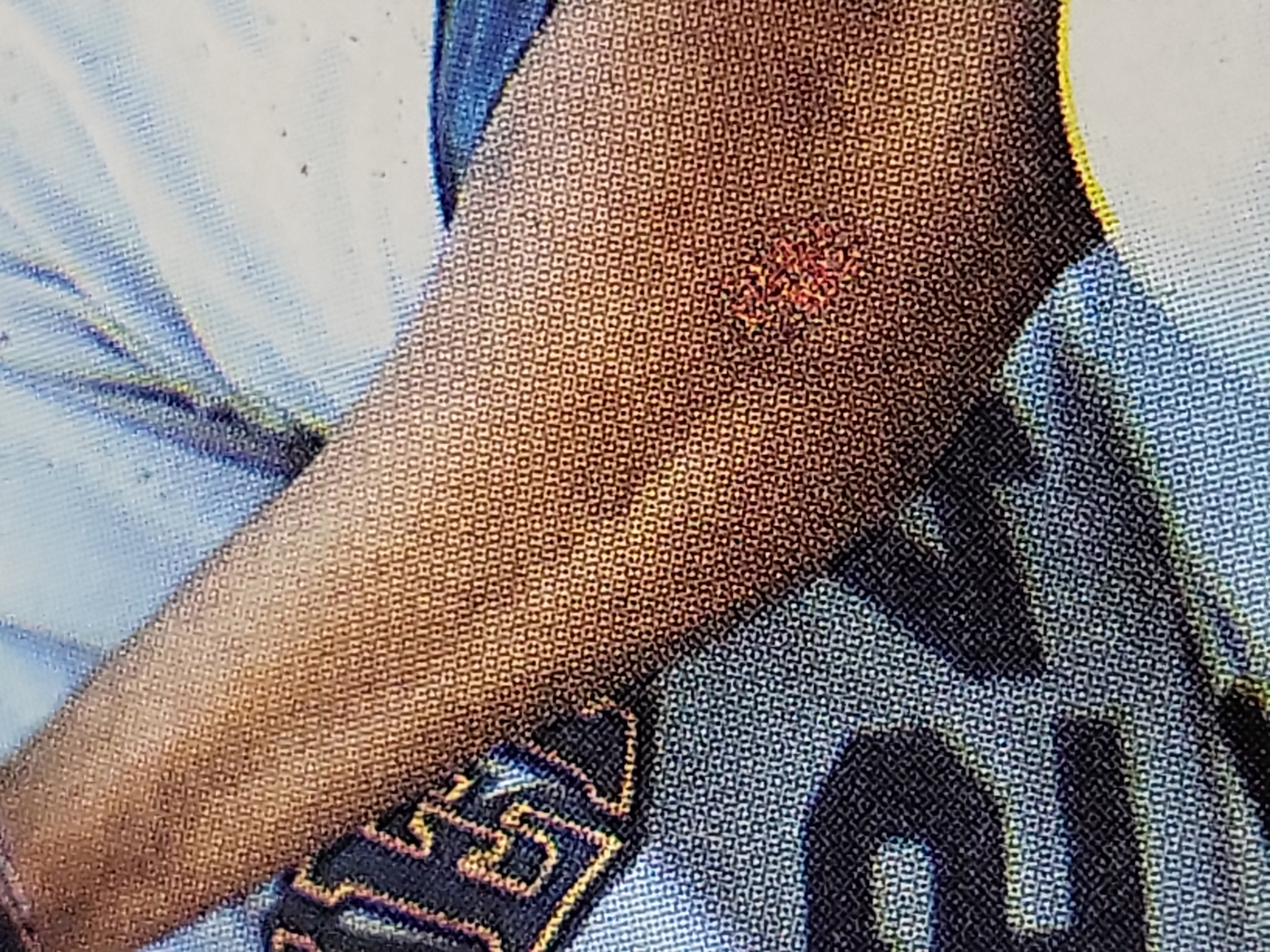 I03883 | 1990 Topps Ken Griffey Jr. All-Star Rookie Card Number 336 Bloody Arm Error