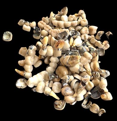 לוט של מתכות דנטליות. ללא זהב. 
משקל ברוטו: כ- 248 גרם.