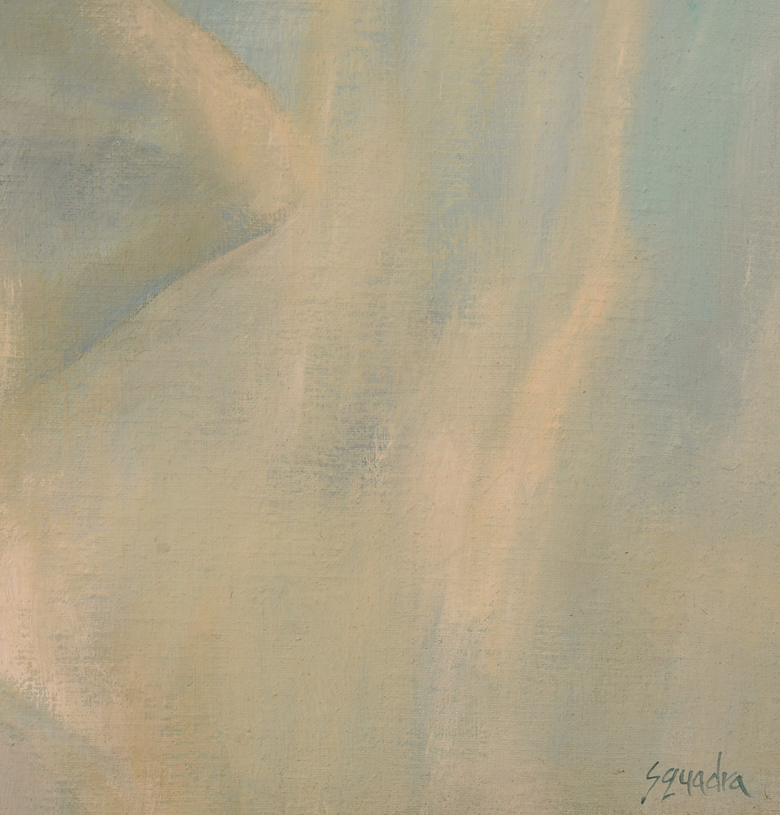 John Squadra (b. 1932). Cataract.