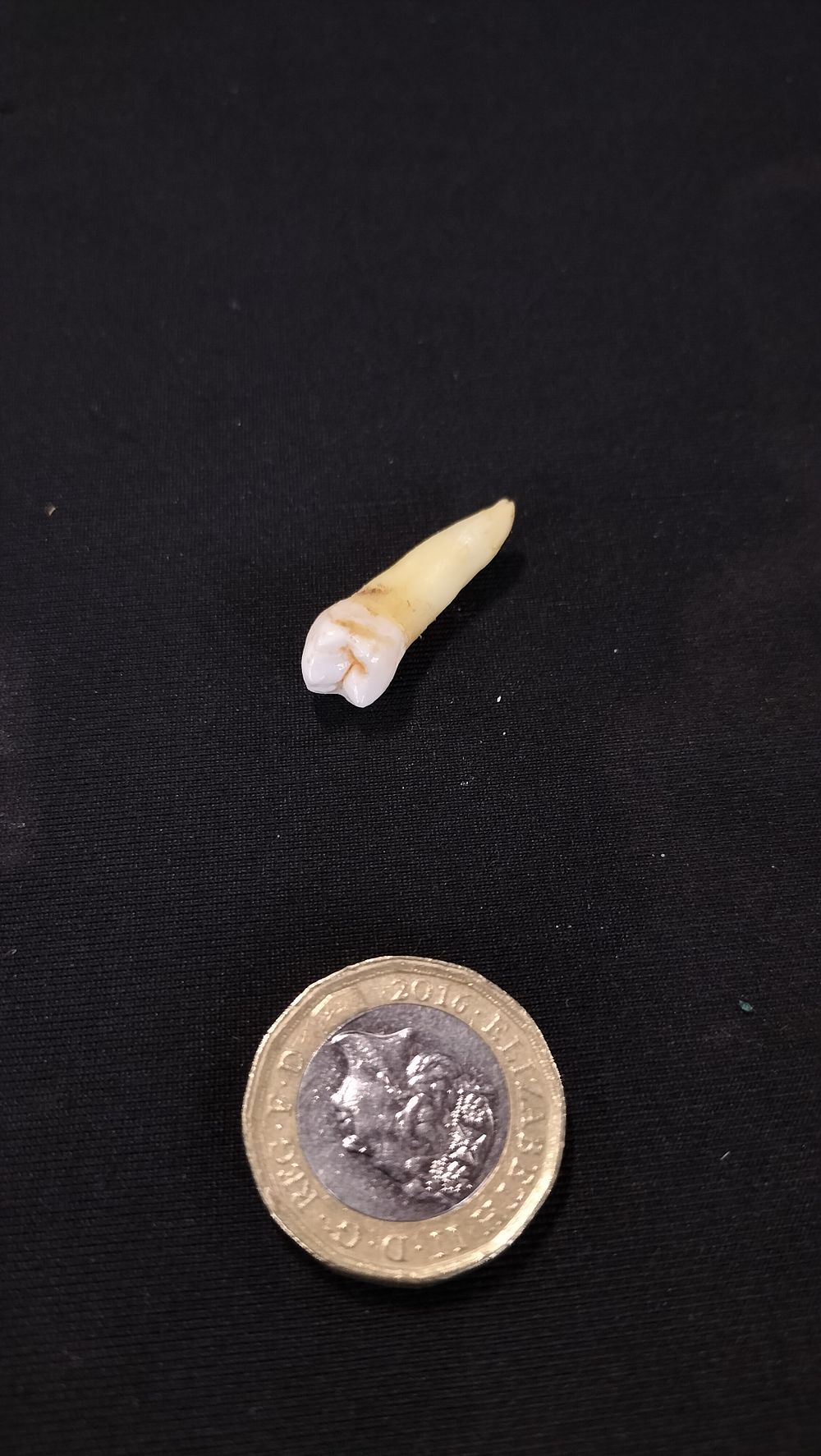 Lot 754: Gary's last tooth. This is how much we...