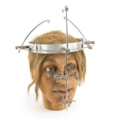 Vintage Wax Head & Surgical Halo Set. This exceptional pairing combines a mid-century life-size 