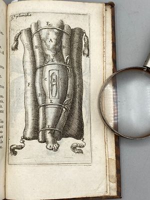 [1712, гравюры] Способ лечить посредством бинтов переломы и вывихи, случающиеся с человеческим 