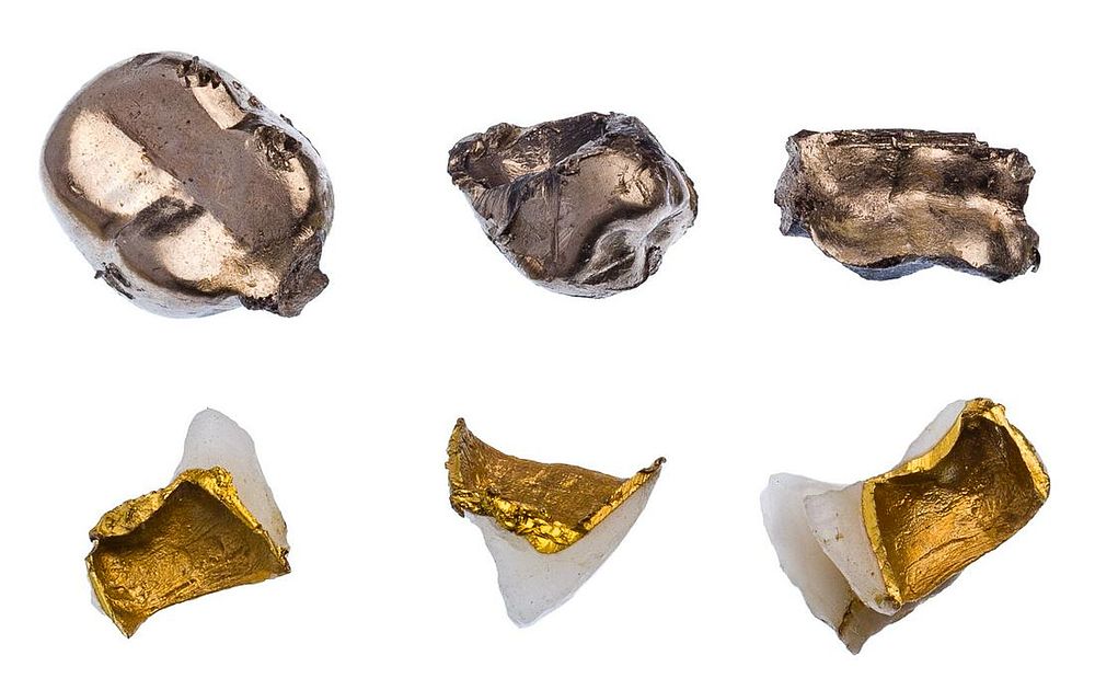 Lot 312: Dental Gold Assortment