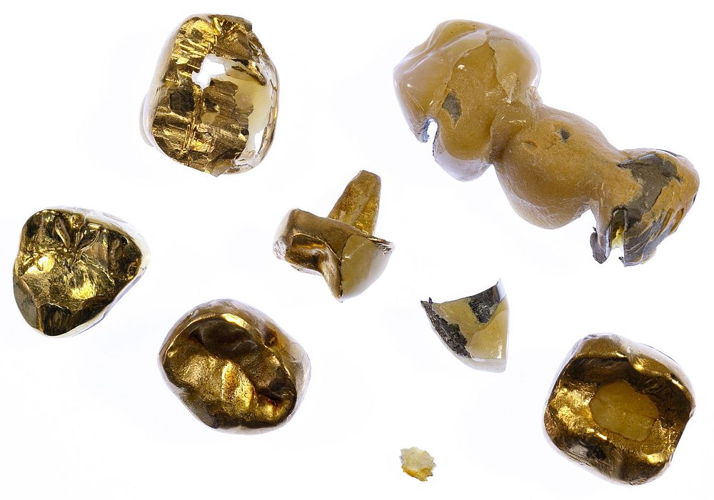 Lot 301: Dental Gold Assortment