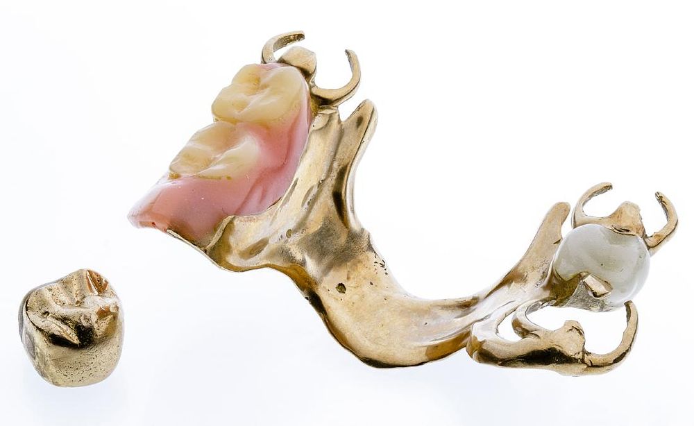Lot 281: Dental Gold Assortment