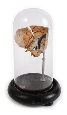 Anatomisches Modellwohl Ende 19. Jh., Partie eines menschlichen Schädels, segmentiert und 