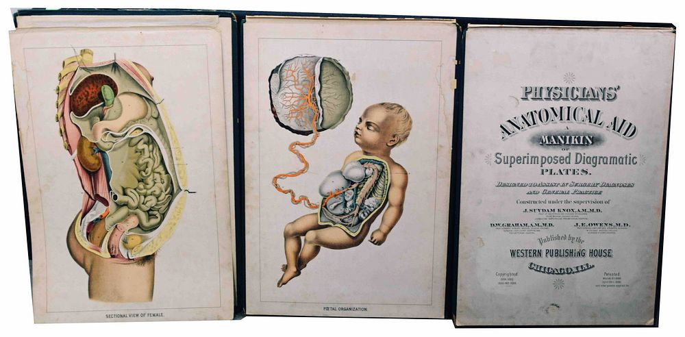 Lot 140: Physicians Anatomical Aid