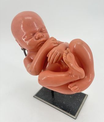Rare 1950s anatomical baby - In latex. 24x18x11cm