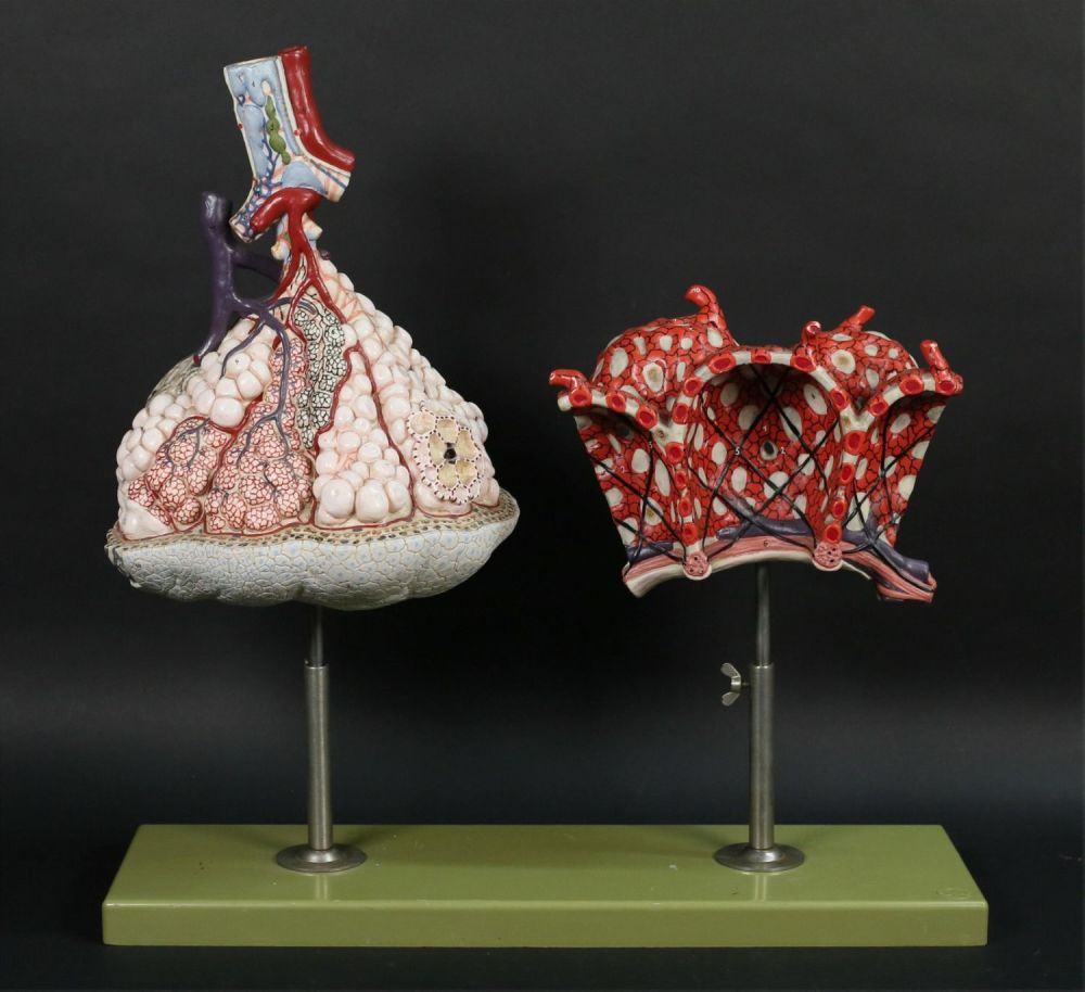 Lot 306: Somso Anatomical Model Lungs & Alveoli