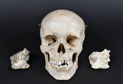 Anatomical Teaching Specimen of a Human Skull with Temporal Dissections. Medical teaching 